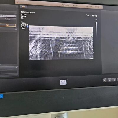 Repair ATL EPIQ5 EPIQ7 original Acquisition module ACQ 453561734844