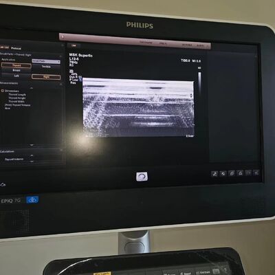 Repair ATL EPIQ5 EPIQ7 original Acquisition module ACQ 453561734844