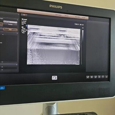 Repair ATL EPIQ5 EPIQ7 original Acquisition module ACQ 453561734844